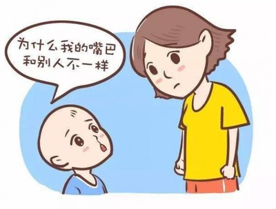 一个兔唇少年的心声